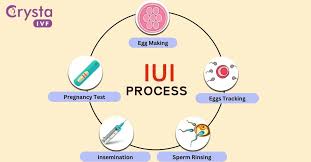 IUI Treatment
