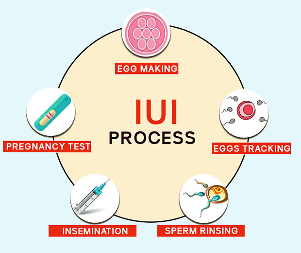 IUI Treatment